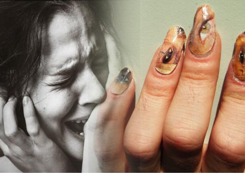 Ногти в фарш! «Чудо-мастера» из провинции превратили пальцы девушки в месиво