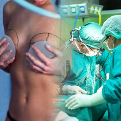 Опасно, рак! Популярные импланты для груди убивают россиянок - блогеры не верят