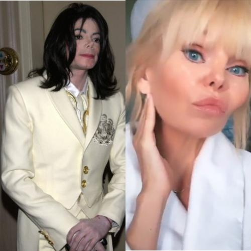 Как Майкл Джексон? Певица Валерия не смогла скрыть «перекроенное» лицо