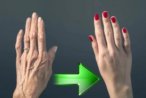 Из пенсионерки в пионерку: Косметолог рассекретил, как остановить «увядание» рук в 3 шага
