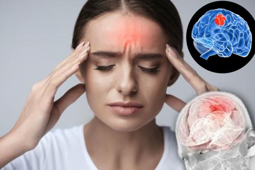 А во лбу мигрень горит: Невролог рассказал о неявных причинах головной боли