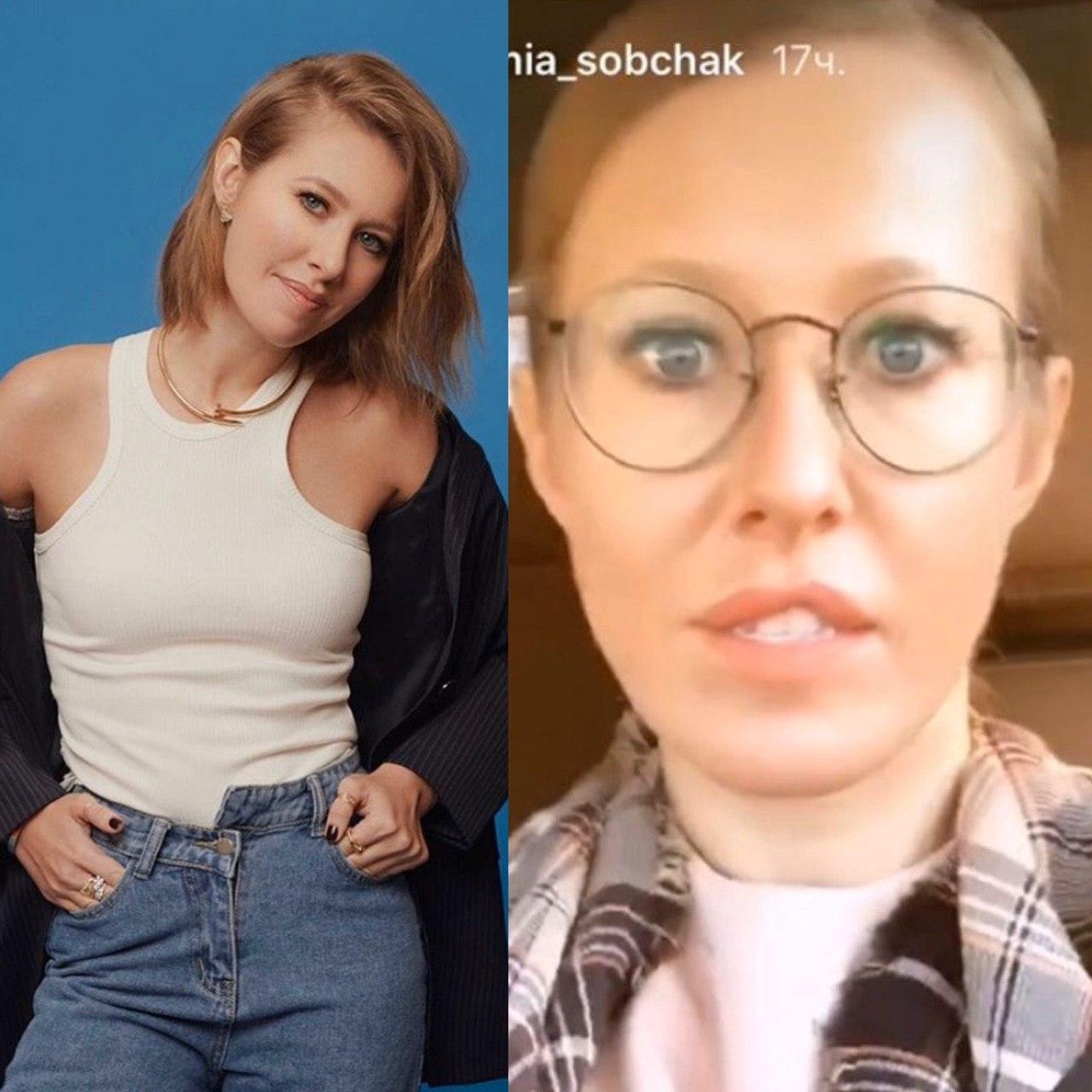 Ксения Собчак до и после пластики фото
